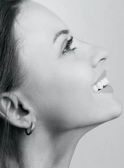 Micro Needling bei Skin Balance Cosmetics